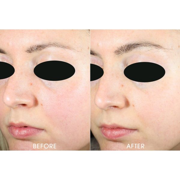 TEOXANE - ACTIVE MICROSCRUB 50 ML - Image 2