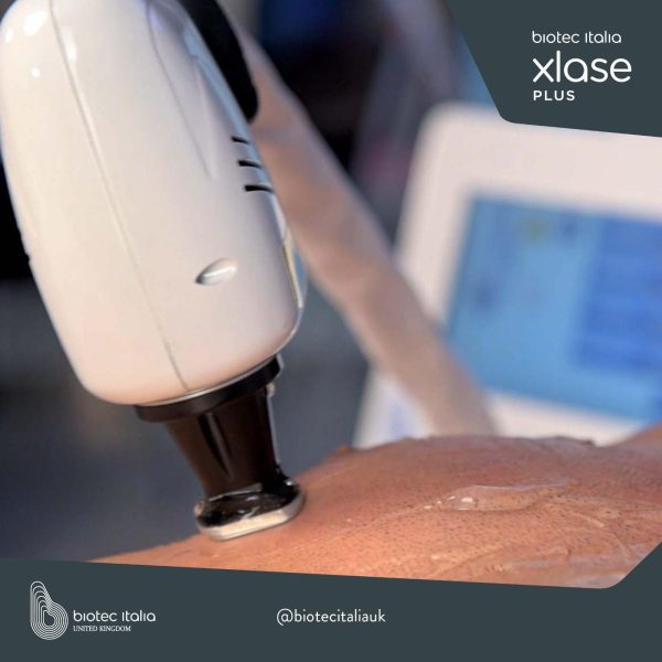 Laser - 60 Minutes Treatment